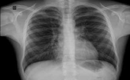 Brava: Delegacia de Saúde com serviço de radiologia a partir da próxima semana